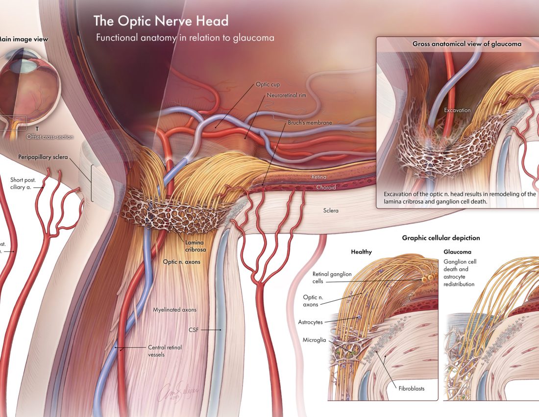 The Optic Nerve Head