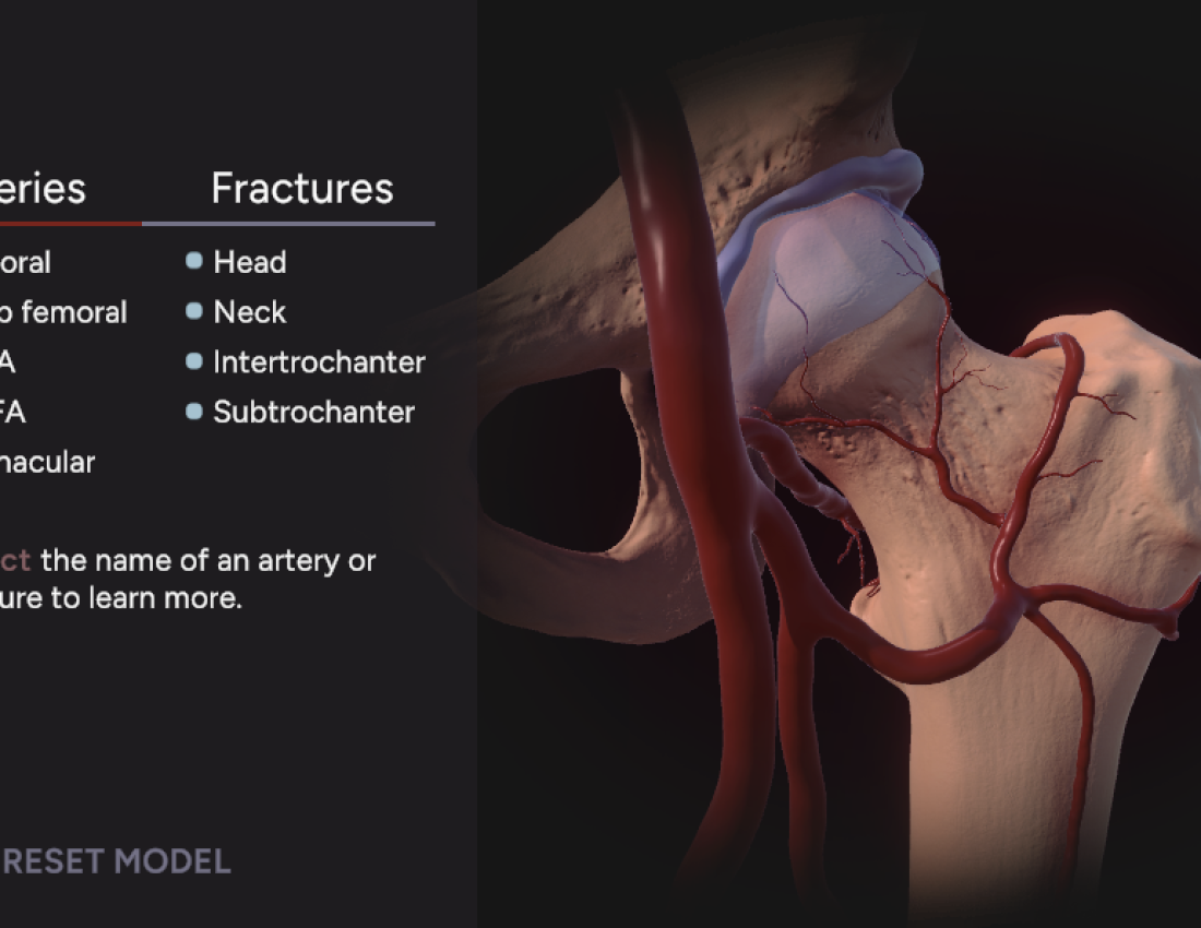 Proximal Femur: Bloodflow and Fractures